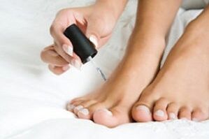 vernis pour le traitement des mycoses des pieds