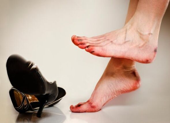 Le développement de champignons sur les ongles des pieds peut être causé par des chaussures serrées